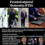FrontotemporalDementia - Trump.jpg